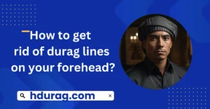 How to get rid of durag lines on your forehead